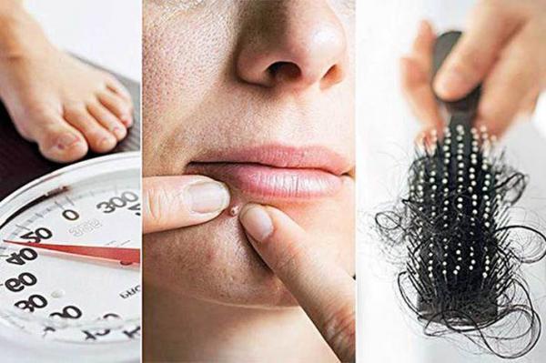 آیا می دانید تنبلی تخمدان دارید؟ آیا می دانید تنبلی تخمدان دارید؟