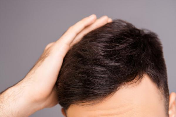 نکات ضروری برای حفظ سلامت مو ها نکات ضروری برای حفظ سلامت مو ها